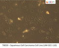 Squamous Cell Carcinoma Cell Line (UM-SCC-110) | Applied Biological Materials (abm)