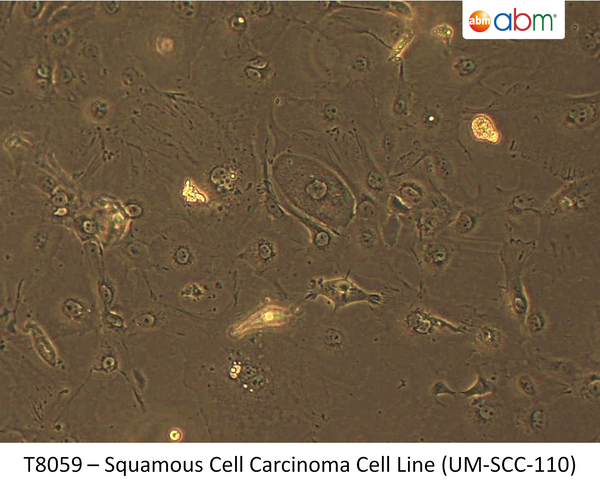Squamous Cell Carcinoma Cell Line (UM-SCC-110) | Applied Biological Materials (abm)