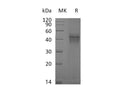 Recombinant Mouse IFNGR1 Protein (His Tag) – Figure 1 of 2
