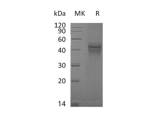 Recombinant Mouse IFNGR1 Protein (His Tag) – Figure 1 of 2