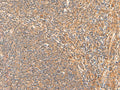 HPCA Polyclonal Antibody – Figure 1 of 3