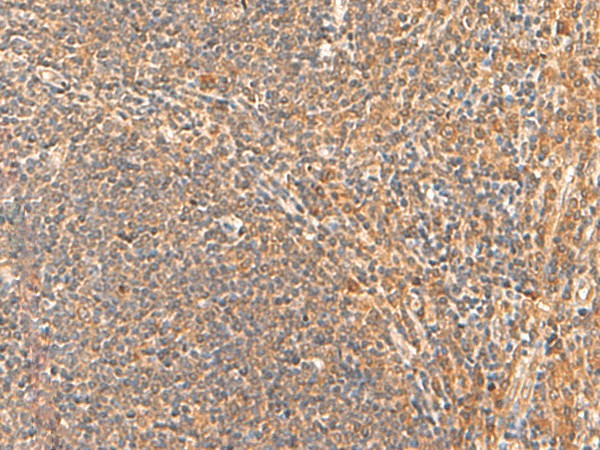 HPCA Polyclonal Antibody – Figure 1 of 3
