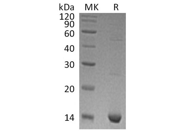 Recombinant Human S100A9 Protein – Figure 1 of 3