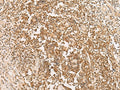 PAX5 Polyclonal Antibody – Figure 1 of 3