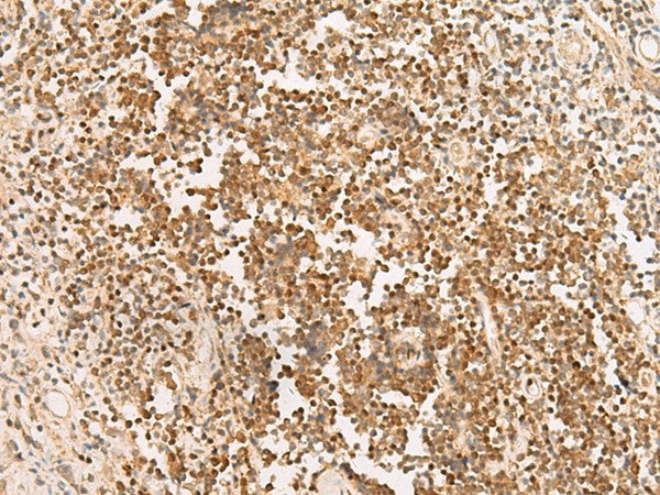 PAX5 Polyclonal Antibody – Figure 1 of 3
