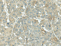 KRT36 Polyclonal Antibody – Figure 1 of 3