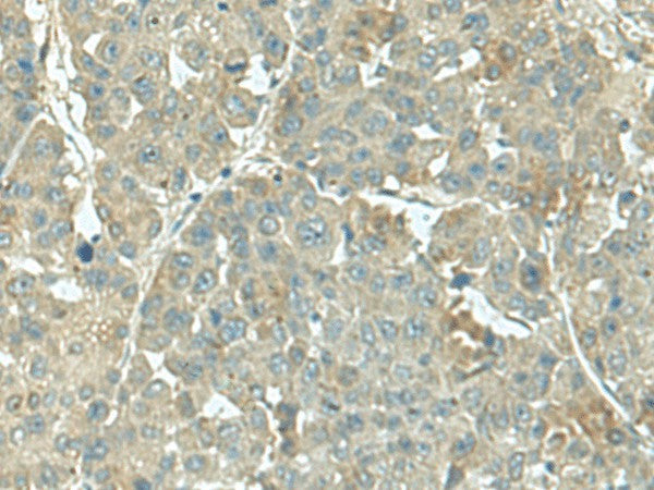 KRT36 Polyclonal Antibody – Figure 1 of 3