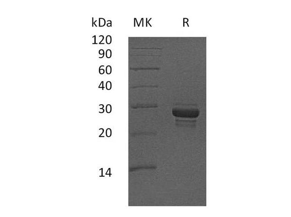 Recombinant Human CALCB Protein (Fc Tag) – Figure 1 of 2