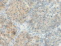 TBXA2R Polyclonal Antibody – Figure 1 of 2