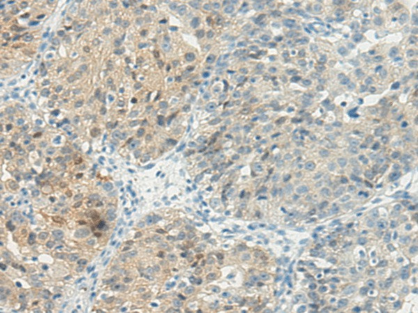 TBXA2R Polyclonal Antibody – Figure 1 of 2
