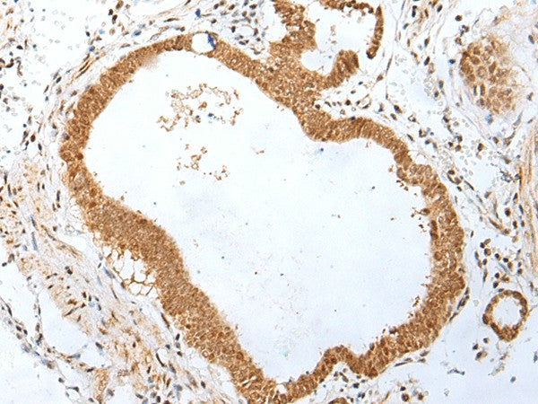 PEG3 Polyclonal Antibody – Figure 1 of 3