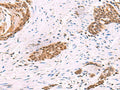 CREBBP Polyclonal Antibody – Figure 1 of 3