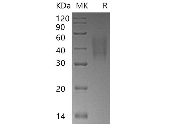 Recombinant Human TRAIL R3/TNFRSF10C Protein (His Tag) – Figure 1 of 2
