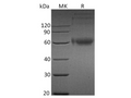 Recombinant Human IL-1RAcP/IL1R3 Protein (His Tag) – Figure 1 of 2