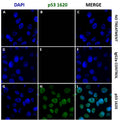MCF-7 breast cancer cells were treated with (
D – I
) or without (
A – C
) 50 nM dox for 24 hrs, incubated with IgG2a isotype control or anti-p53 PAb-1620 diluted 1:1000. Donkey-anti-mouse iFluor™ 488 (
green, B, E, H
) was used in a dilution of 1:1000, and DAPI was applied for detection of nuclei (
blue, A, D, G
).