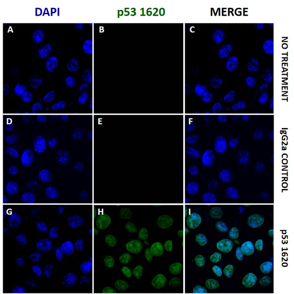 MCF-7 breast cancer cells were treated with (
D – I
) or without (
A – C
) 50 nM dox for 24 hrs, incubated with IgG2a isotype control or anti-p53 PAb-1620 diluted 1:1000. Donkey-anti-mouse iFluor™ 488 (
green, B, E, H
) was used in a dilution of 1:1000, and DAPI was applied for detection of nuclei (
blue, A, D, G
).
