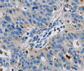 GRIA3 Polyclonal Antibody – Figure 1 of 3