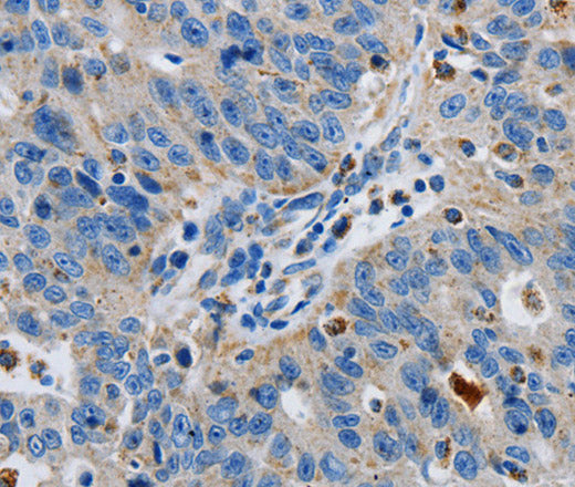 GRIA3 Polyclonal Antibody – Figure 1 of 3