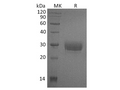 Recombinant Human CD32a/FCGR2A Protein (H131, His Tag) – Figure 1 of 3