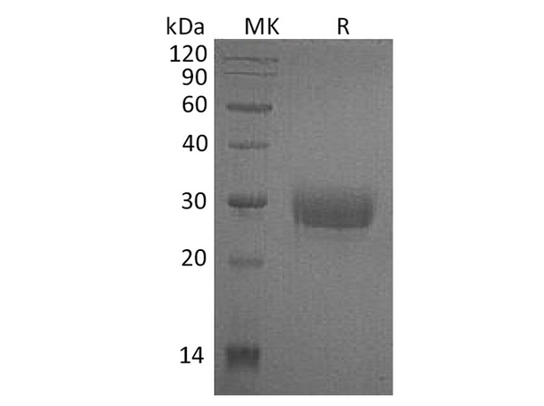 Recombinant Human CD32a/FCGR2A Protein (H131, His Tag) – Figure 1 of 3