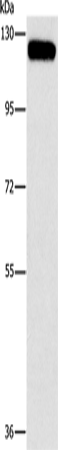 CBL Polyclonal Antibody – Figure 1 of 2