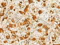 C11orf54 Polyclonal Antibody – Figure 1 of 2