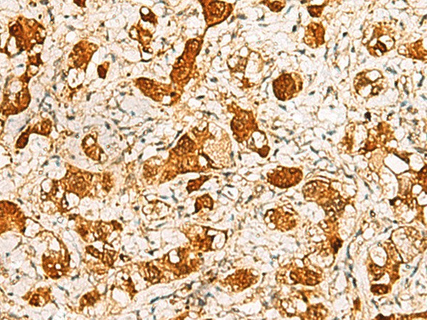 C11orf54 Polyclonal Antibody – Figure 1 of 2
