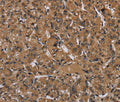 HIF1 alpha Polyclonal Antibody – Figure 1 of 3