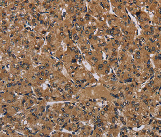 HIF1 alpha Polyclonal Antibody – Figure 1 of 3