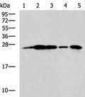 UCHL1 Polyclonal Antibody – Figure 1 of 3