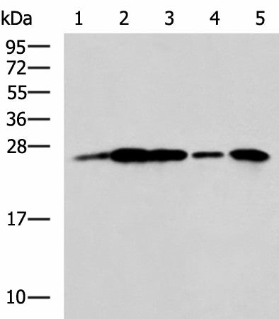 UCHL1 Polyclonal Antibody – Figure 1 of 3