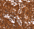HCAR2 Polyclonal Antibody – Figure 1 of 3