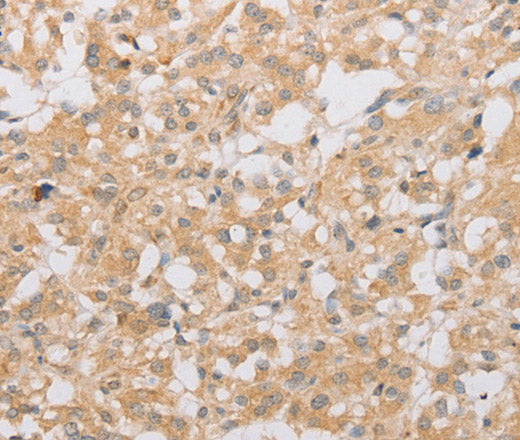 ATG9A Polyclonal Antibody – Figure 1 of 3