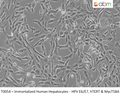 Immortalized Human Hepatocytes - HPV E6/E7, hTERT & MycT58A | Applied Biological Materials (abm)