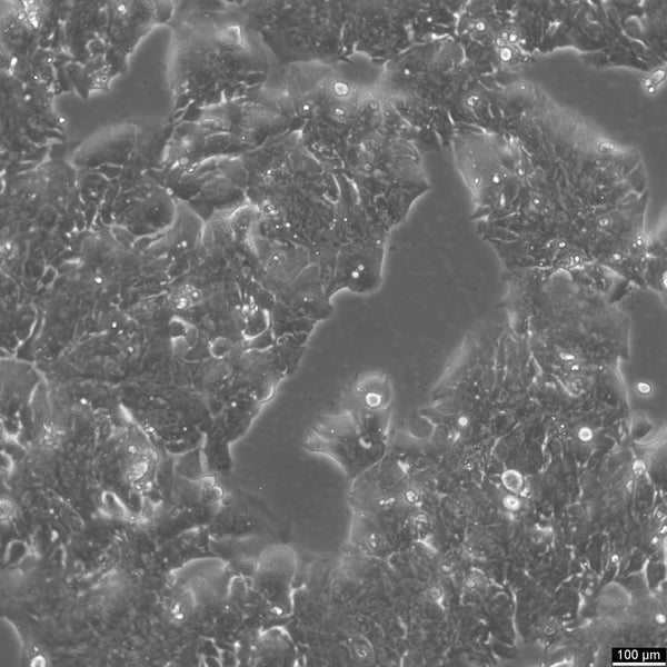 HROC334 cell