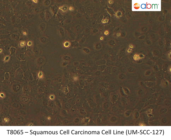 Squamous Cell Carcinoma Cell Line (UM-SCC-127) | Applied Biological Materials (abm)