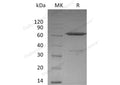 Recombinant Mouse Ephrin-A3/EFNA3 Protein (Fc Tag) – Figure 1 of 2
