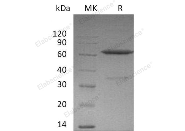 Recombinant Mouse Ephrin-A3/EFNA3 Protein (Fc Tag) – Figure 1 of 2