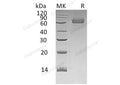Recombinant Human TGOLN2/TGN38 Homolog Protein (His Tag) – Figure 1 of 2