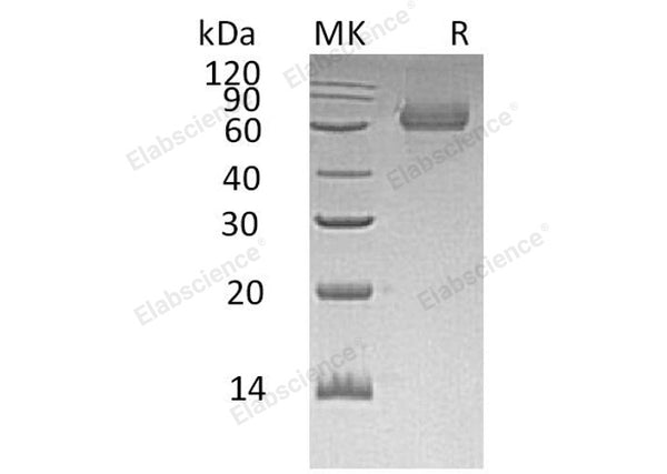 Recombinant Human TGOLN2/TGN38 Homolog Protein (His Tag) – Figure 1 of 2