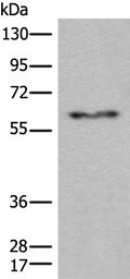 CES2 Polyclonal Antibody – Figure 1 of 3