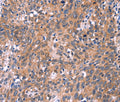 EDN1 Polyclonal Antibody – Figure 1 of 3