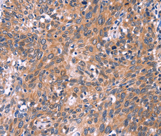 EDN1 Polyclonal Antibody – Figure 1 of 3