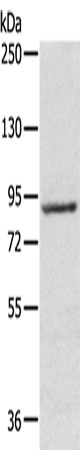 RPS6KA1 Polyclonal Antibody – Figure 1 of 3