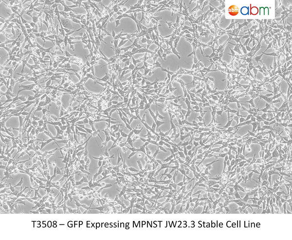 GFP Expressing MPNST JW23.3 Stable Cell Line | Applied Biological Materials (abm)