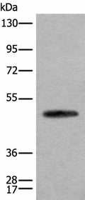 CADM2 Polyclonal Antibody – Figure 1 of 3