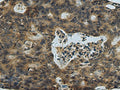 PLTP Polyclonal Antibody – Figure 1 of 2