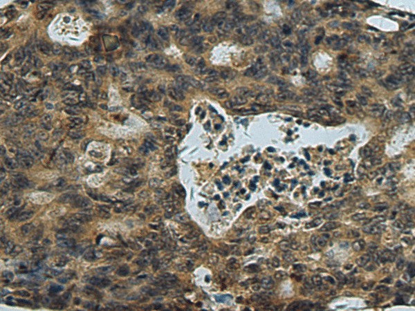 PLTP Polyclonal Antibody – Figure 1 of 2
