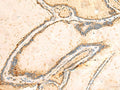 IGFBPL1 Polyclonal Antibody – Figure 1 of 2