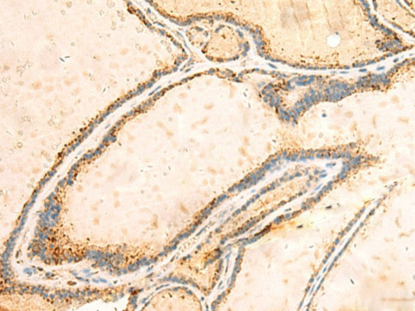 IGFBPL1 Polyclonal Antibody – Figure 1 of 2